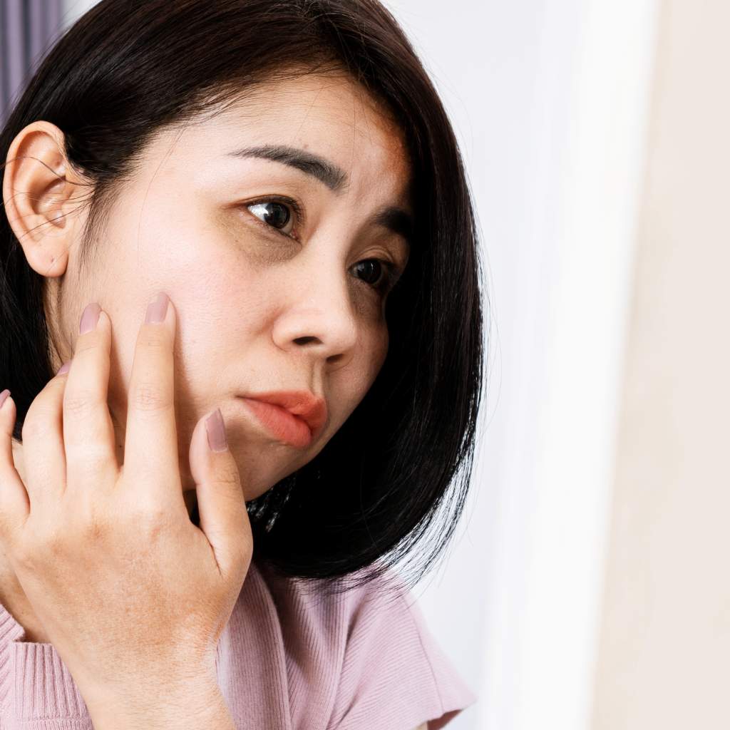 dark circles treatment in dubai