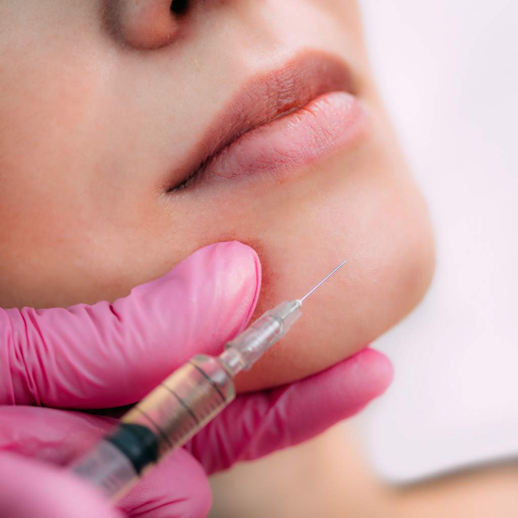 Dermal Fillers for Chin in dubai