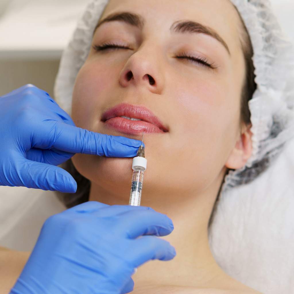 Lip Enhancement with Dermal Fillers in Dubai